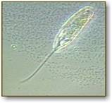 http://www.microscope-microscope.org/applications/pond-critters/protozoans/images/peranema.jpg